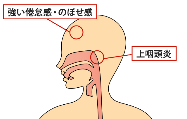 症状の該当箇所のイラスト
