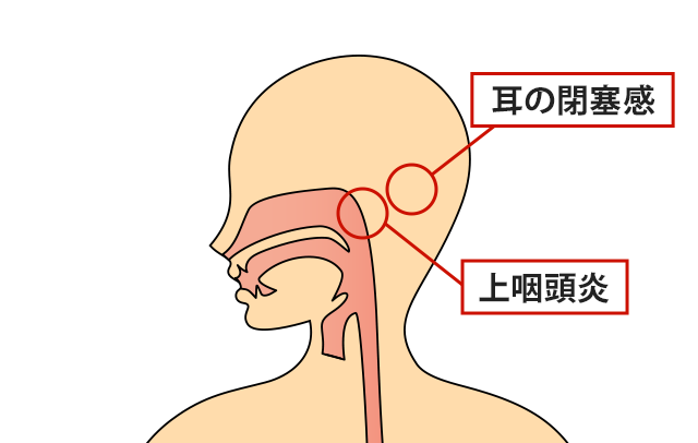 症状の該当箇所のイラスト
