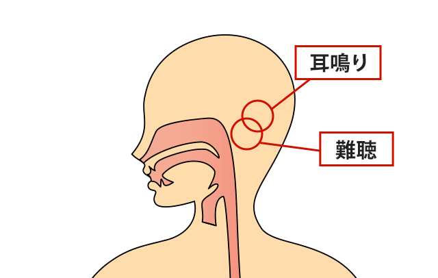 症状の該当箇所のイラスト