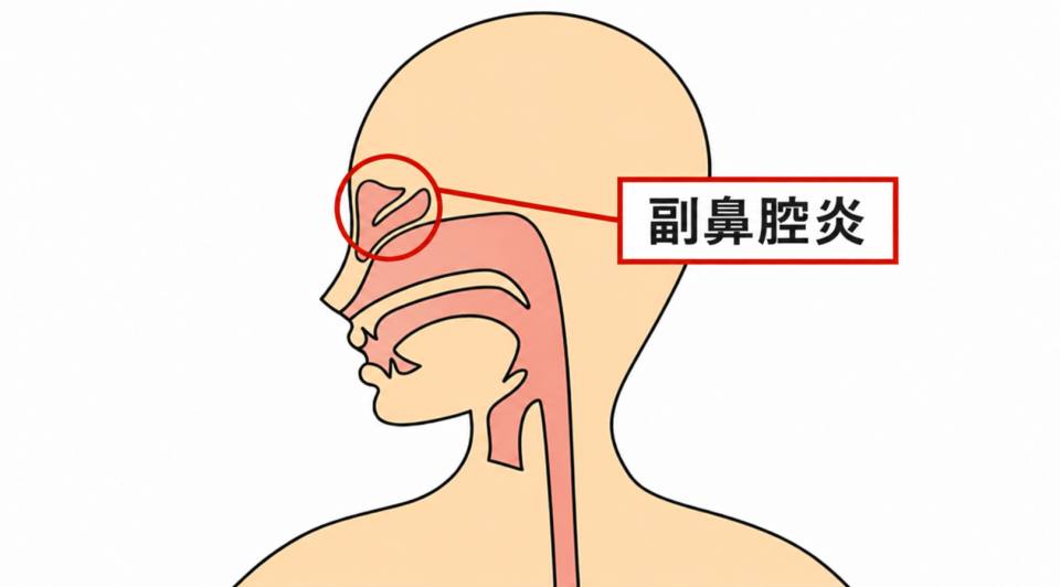 症状の該当箇所のイラスト