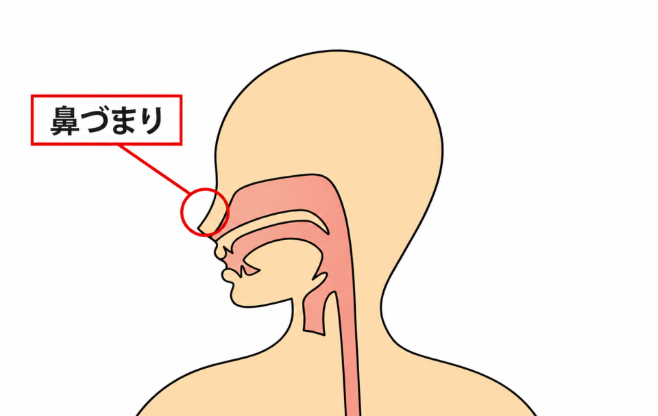 症状の該当箇所のイラスト