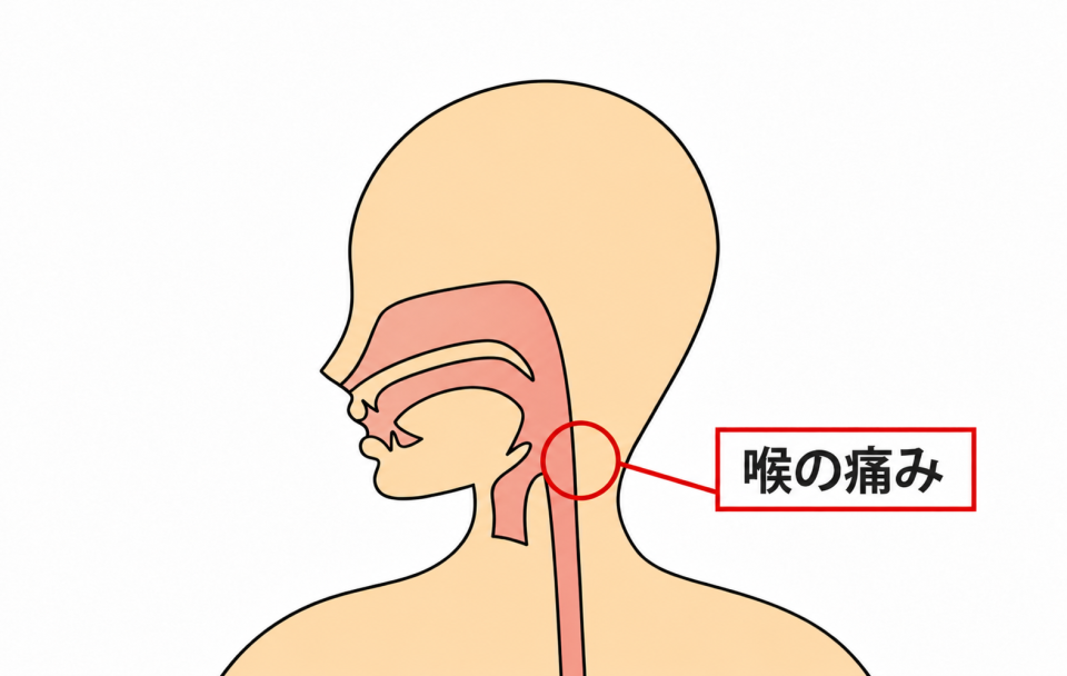 症状の該当箇所のイラスト