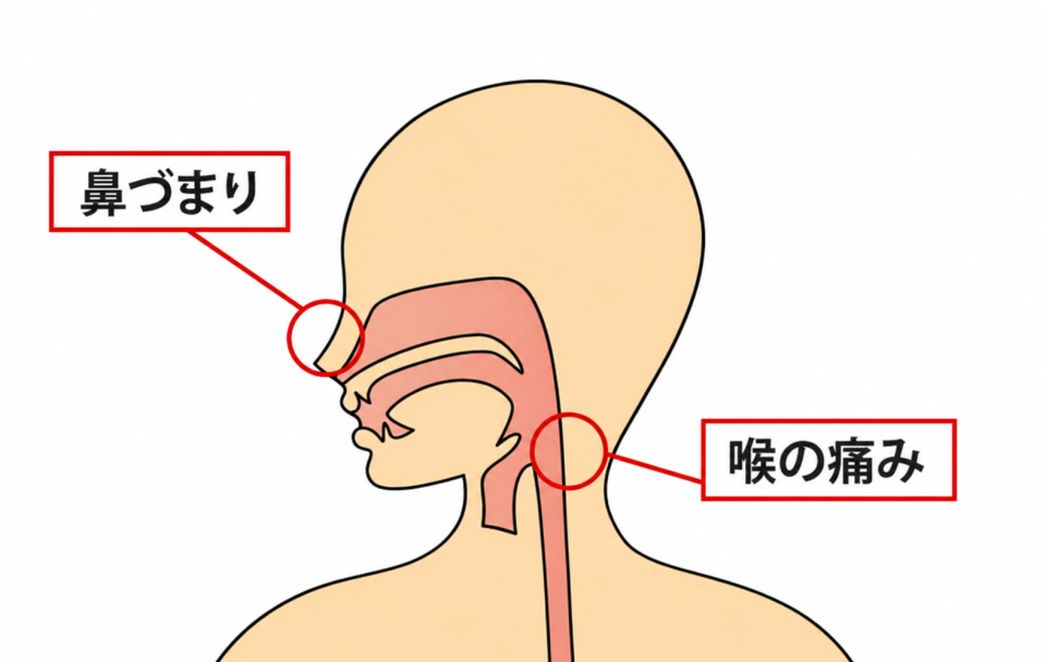 症状の該当箇所のイラスト